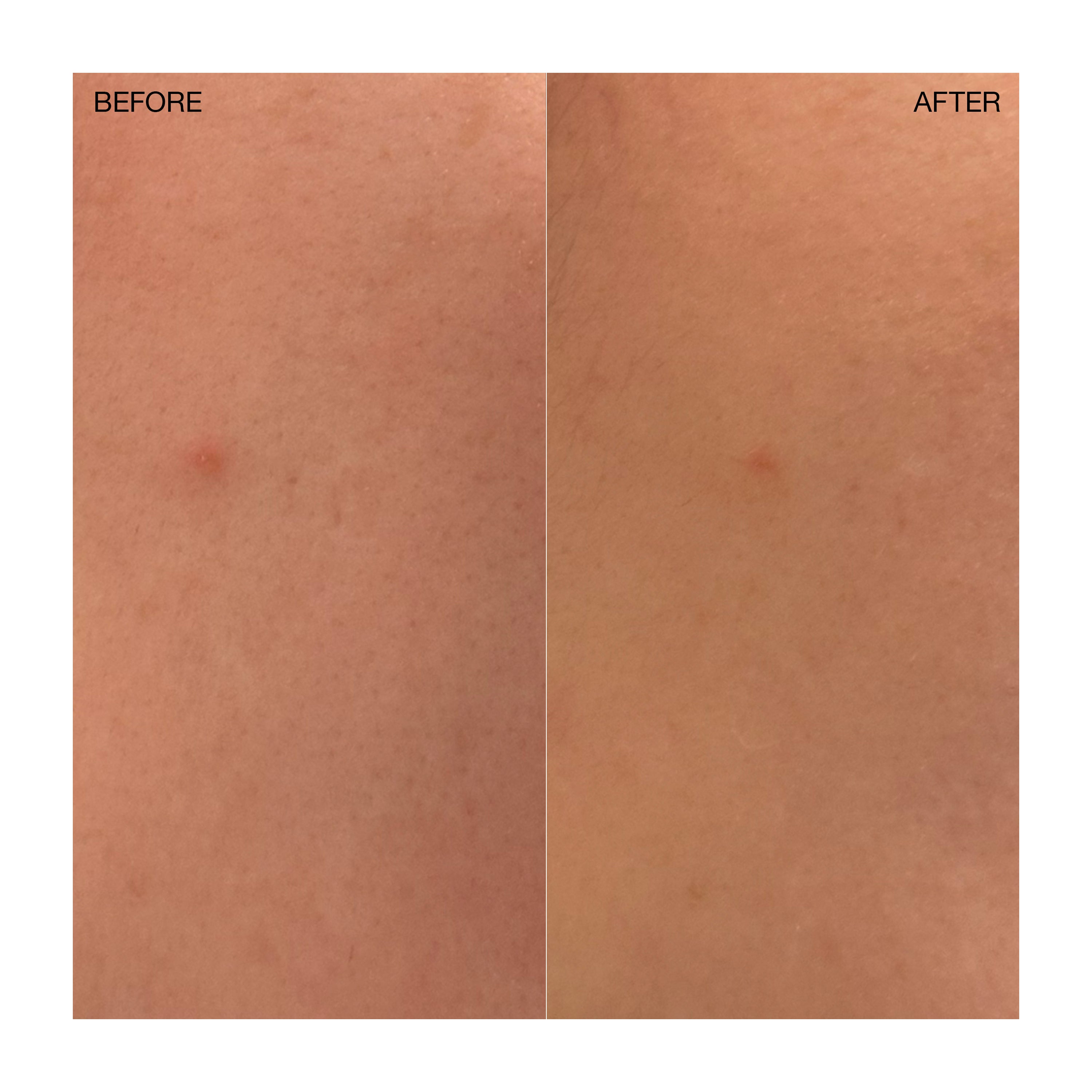 Targeted Blemish Treatment - Image 6
